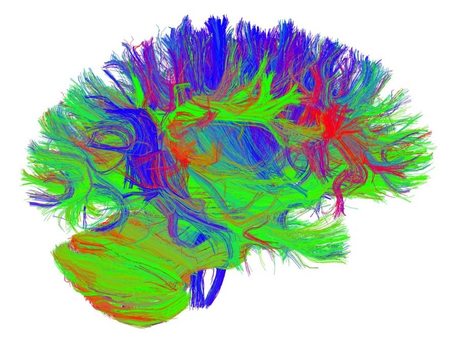 Obrazowanie szlaków włókien w żywym mózgu przy pomocy analizy tensora dyfuzji (DTI) -