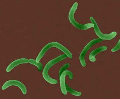 pałeczki krętki laseczki (bacillus): dłuŝsze,