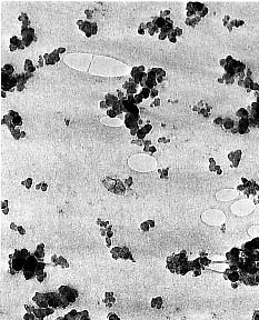 Przykłady kompozytów ziarnistych (particulates) Polimery: + napełniacze ziarniste: talk, kreda, piasek, zmielone laminaty (Obniżenie ceny, wzrost sztywnosci i odporności cieplnej np.