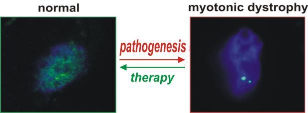 Aktywności Naukowe Molekularny patomechanizm chorób człowieka Patomechanizm dystrofii miotonicznej Oddziaływanie toksycznych cząsteczek RNA z białkami metabolizm RNA Transkryptomiczna analiza zmian