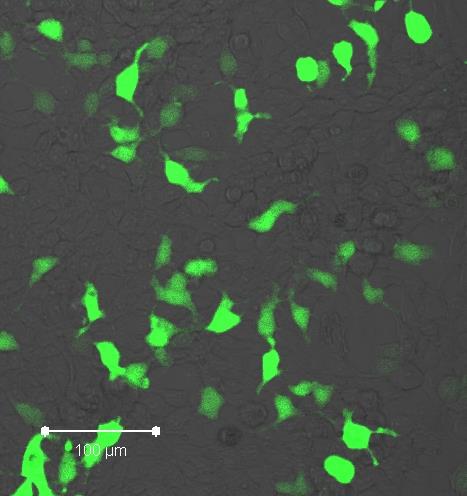 ETIOLOGIA CHOROBY PROGNOZY - TERAPIA Transplantacja i nowotwór nerki in vivo transdukcja sygnałów ekspresja genów