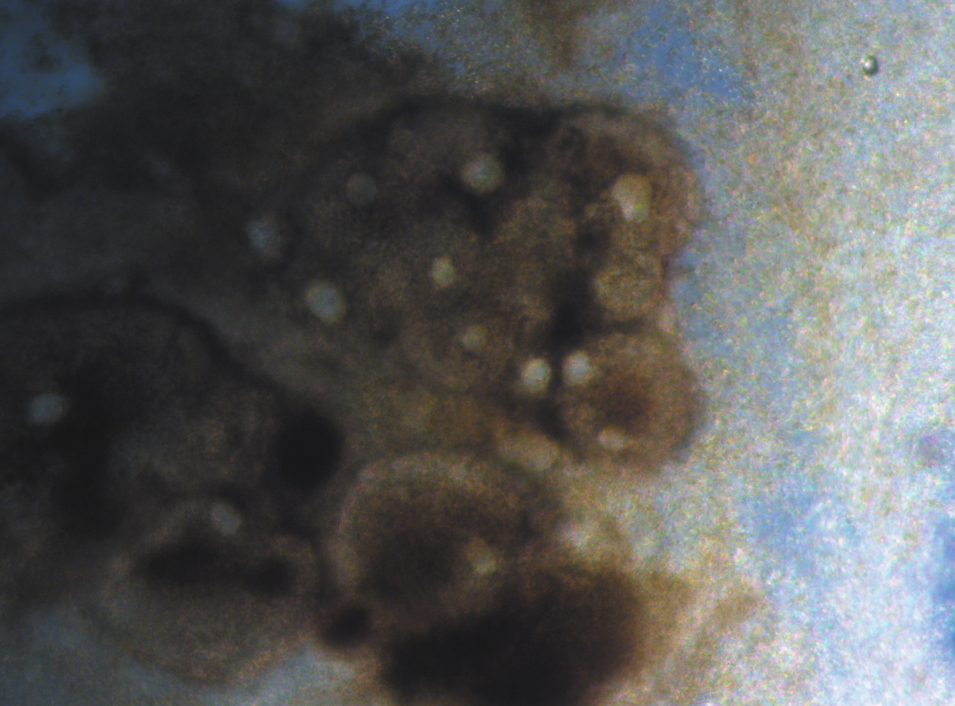 64 Elżbieta Pląskowska i wsp. Fot. 5. Piknidia Phomopsis scabra widoczne pod mikroskopem Phot. 5. Picnidia of Phomopsis scabra observed under a microscope WNIOSKI 1.