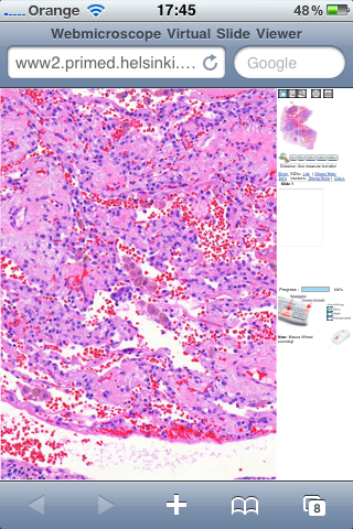 Przygotowanie 21th European Congress of Pathology 2007 Digitalizacja 154 preparatów histologicznych Każdy preparat ca. 83.000 x 140.