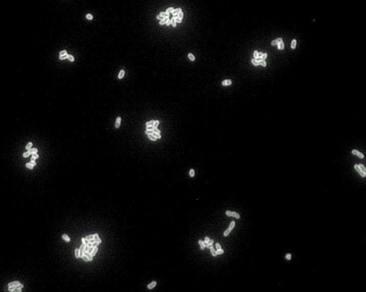Rys. 2. Mikroskopowy obraz reakcji krzyżowej izolatu bakterii 142.5 uzyskany w teście IFAS z zastosowaniem przeciwciał poliklonalnych (powiększenie 1000x) Fig. 2. Microscopic image of cross-reacting bacterial isolate 142.