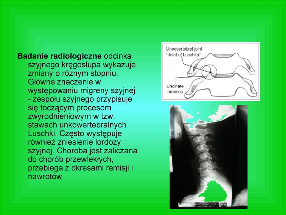 procesom zwyrodnieniowym w tzw. stawach unkowertebralnych Luschki.