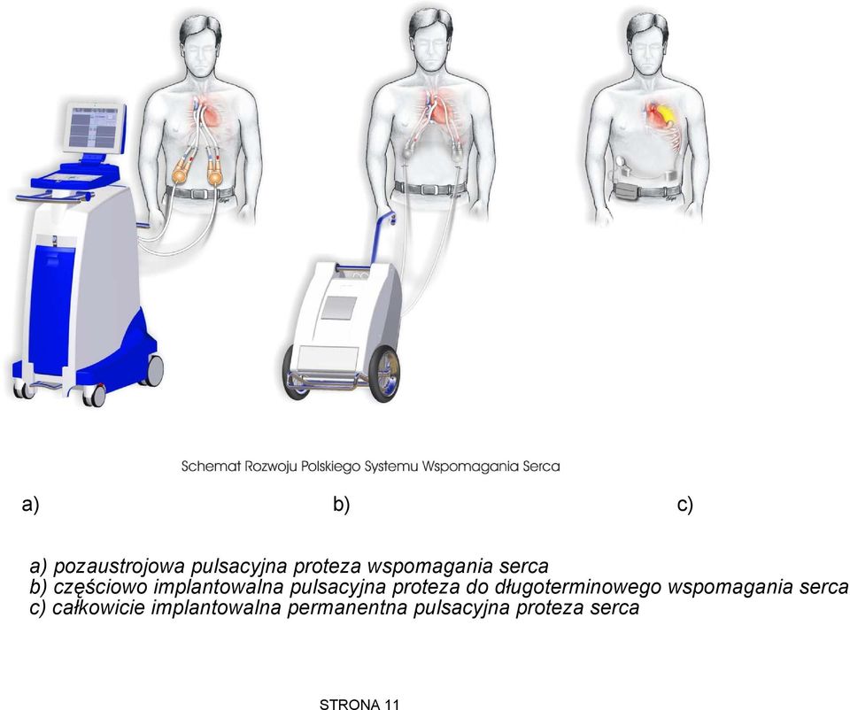 proteza do długoterminowego wspomagania serca c)