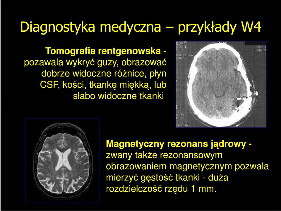 słabo widoczne tkanki.