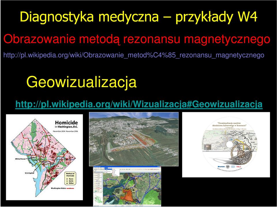 org/wiki/obrazowanie_metod%c4%85_rezonansu_magnetycznego