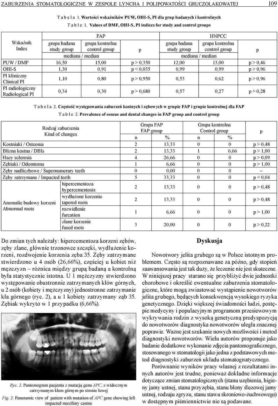 p mediana / median mediana / median PUW / DMF 16,50 15,00 p > 0,350 12,00 13,00 p > 0,46 OHI-S 1,30 0,91 p < 0,035 0,99 0,99 p > 0,96 PI kliniczny Clinical PI 1,10 0,80 p > 0,950 0,53 0,62 p > 0,96