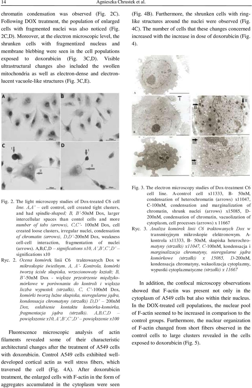 Visible ultrastructural changes also included the swollen mitochondria as well as electron-dense and electronlucent vacuole-like structures (Fig. 3C,E). (Fig. 4B).