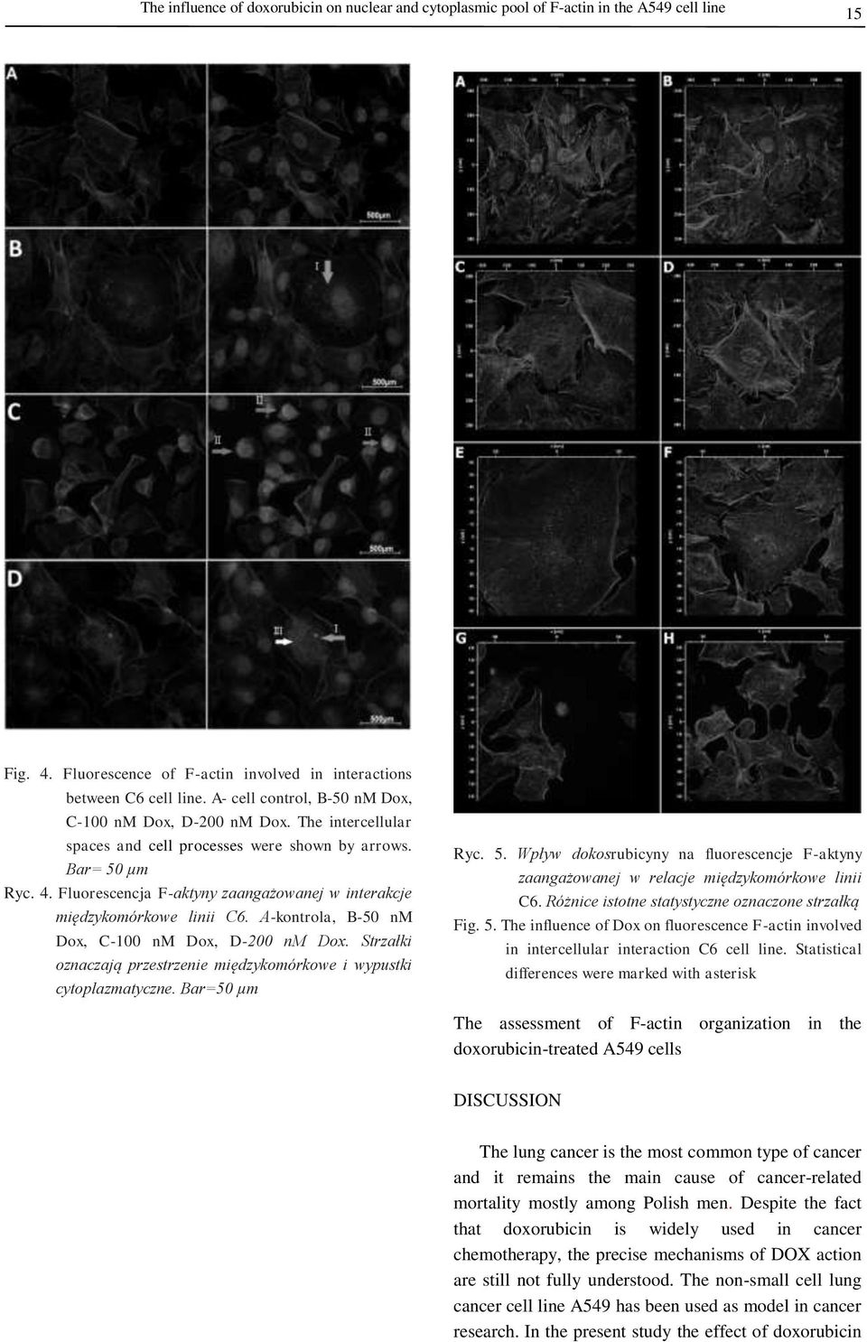 Fluorescencja F-aktyny zaangażowanej w interakcje międzykomórkowe linii C6. A-kontrola, B-50 nm Dox, C-100 nm Dox, D-200 nm Dox.