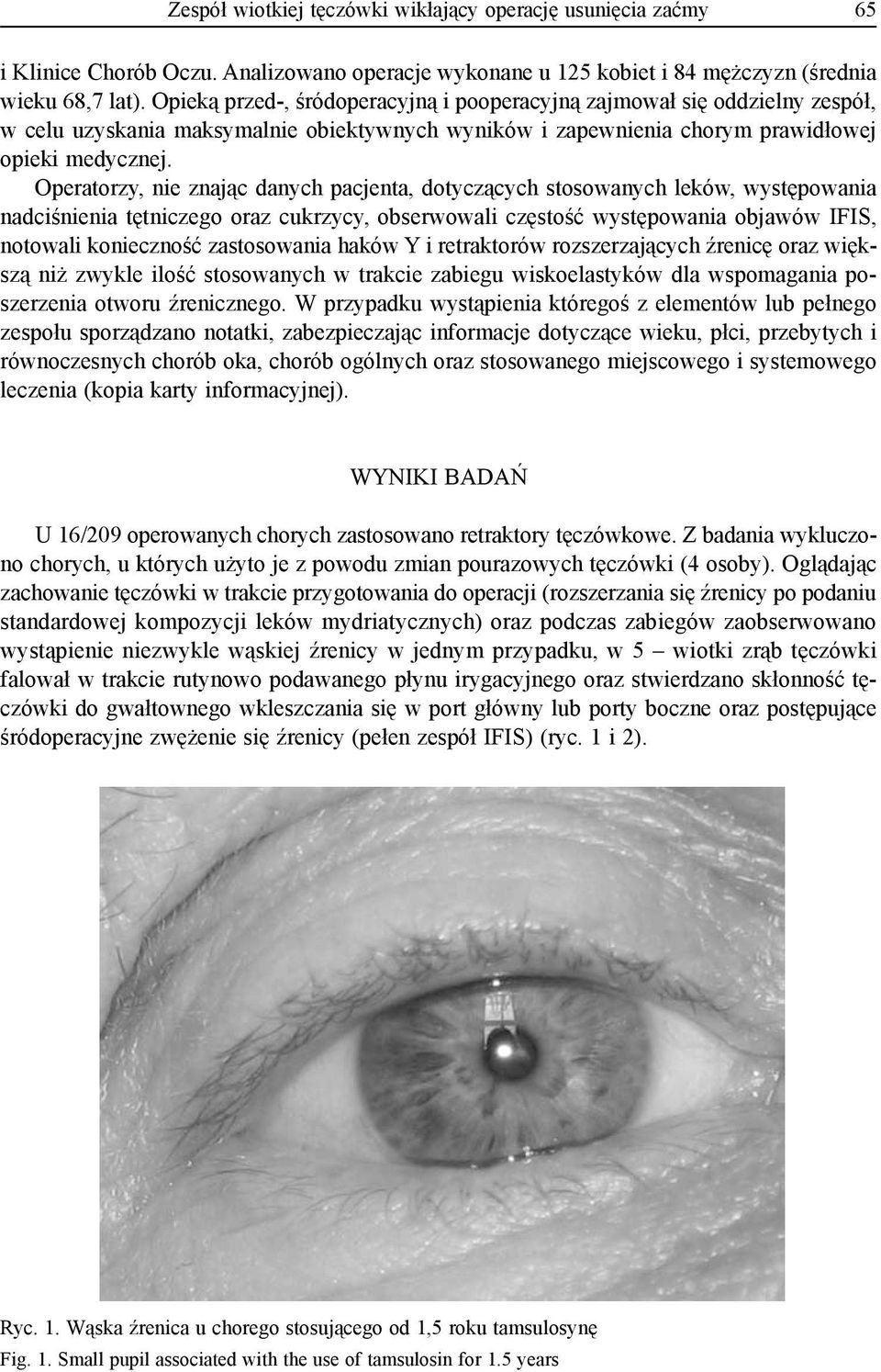 Operatorzy, nie znając danych pacjenta, dotyczących stosowanych leków, występowania nadciśnienia tętniczego oraz cukrzycy, obserwowali częstość występowania objawów IFIS, notowali konieczność