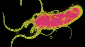 Remedium na wrzody Probiotyki mogą okazać się skuteczne w zwalczaniu Helicobacter pylori bakterii kojarzonej głównie z wrzodami żołądka i dwunastnicy. Helicobacter pylori to Gram(-) spiralna bakteria.