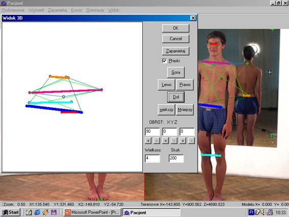 Rys.3. Widok okna programu PACJENT 3D, rzut połączonych odcinkami punktów na płaszczyznę poziomą. 4. Badanie niektórych elementów składowych systemu 4.1.