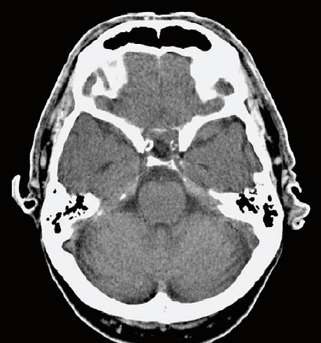 Anatomia Zbiornik