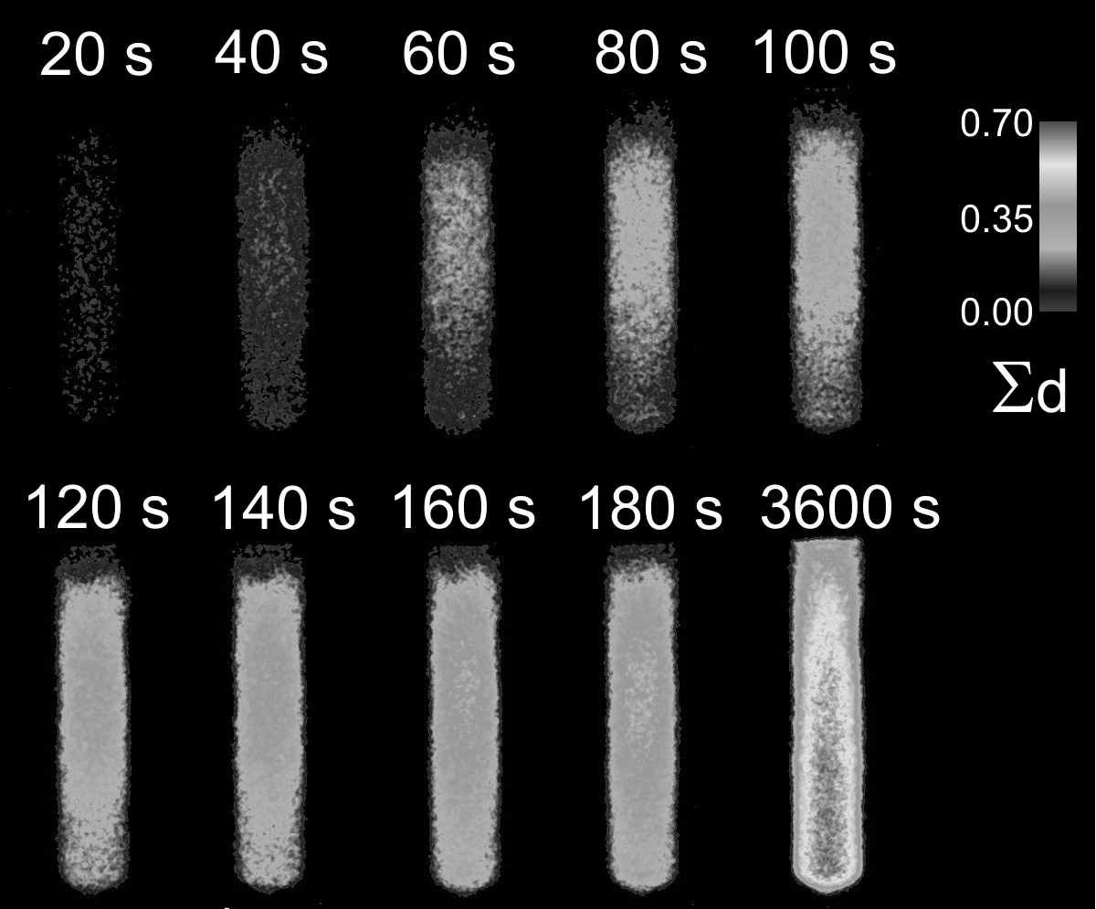 spatial resolution of 70 µm (0.07mm). Comparing 