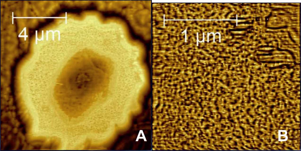 irradiated red blood cells isolated from healthy donor.