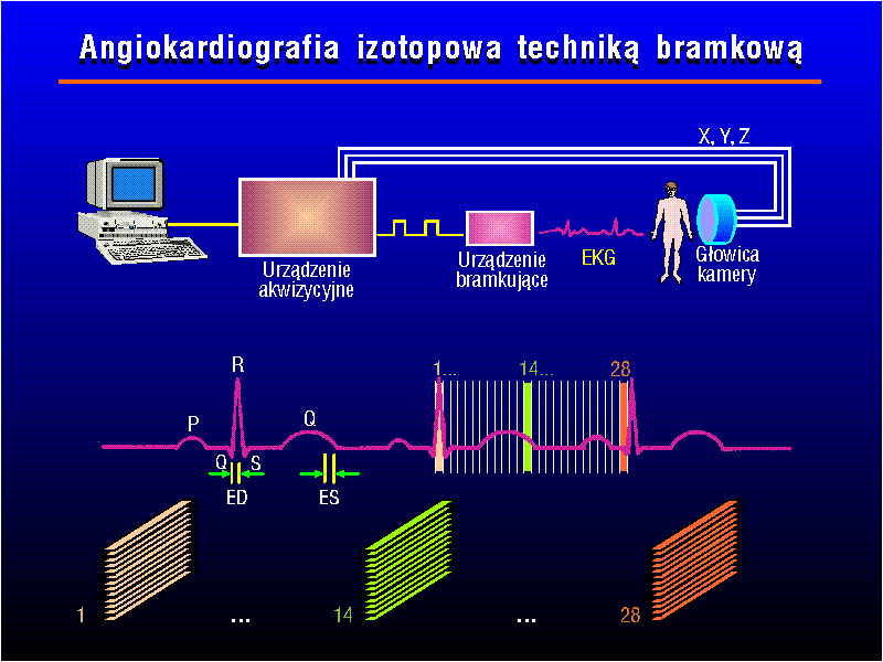 Angiokardiografia radioizotopowa techniką