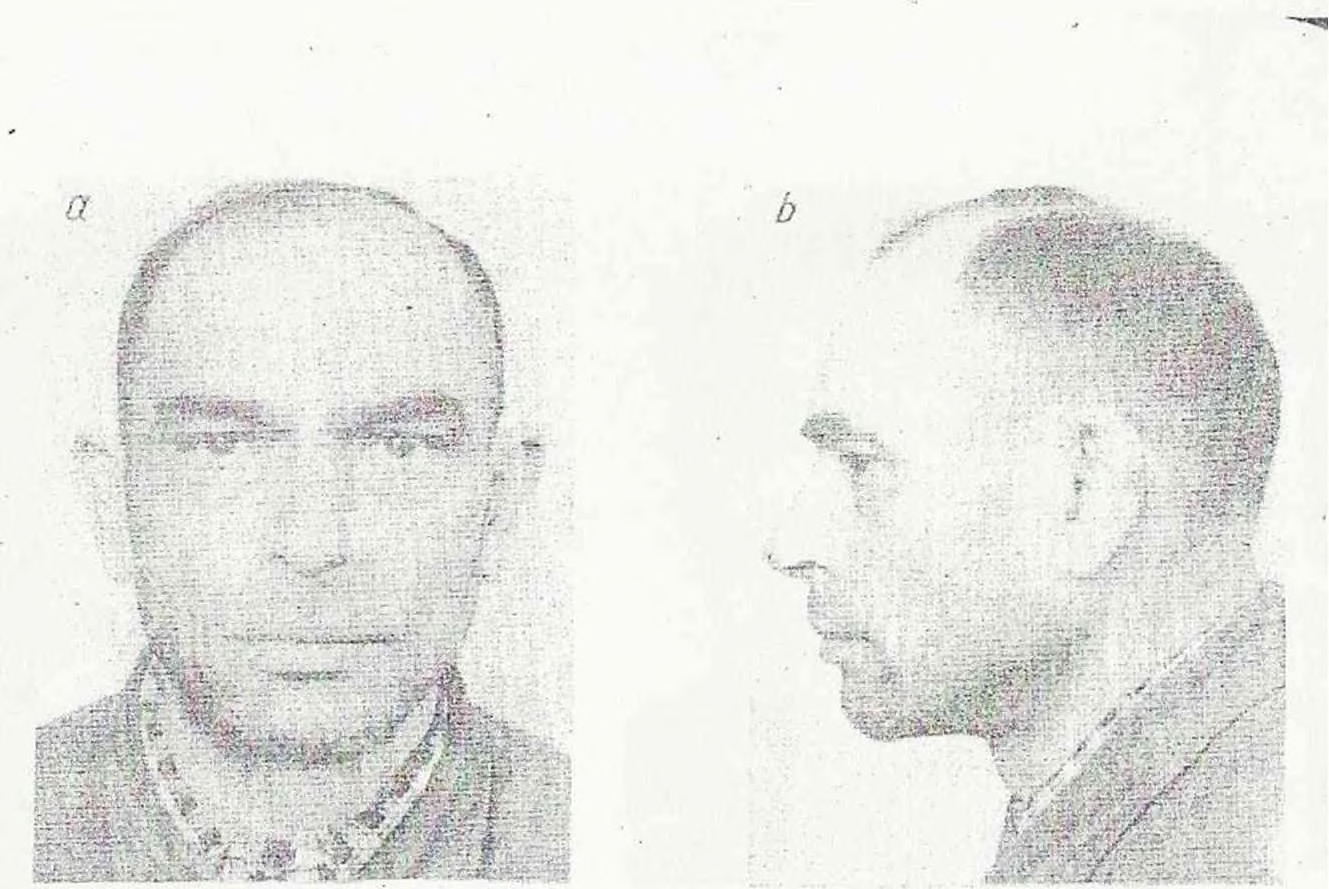 Fot. 7u i b. Przedstawiciel typu południowo-wschodniego (EQ), (mieszaniec rasy śródziemnomorskiej z rasą wyżynną) Wzrost różny.