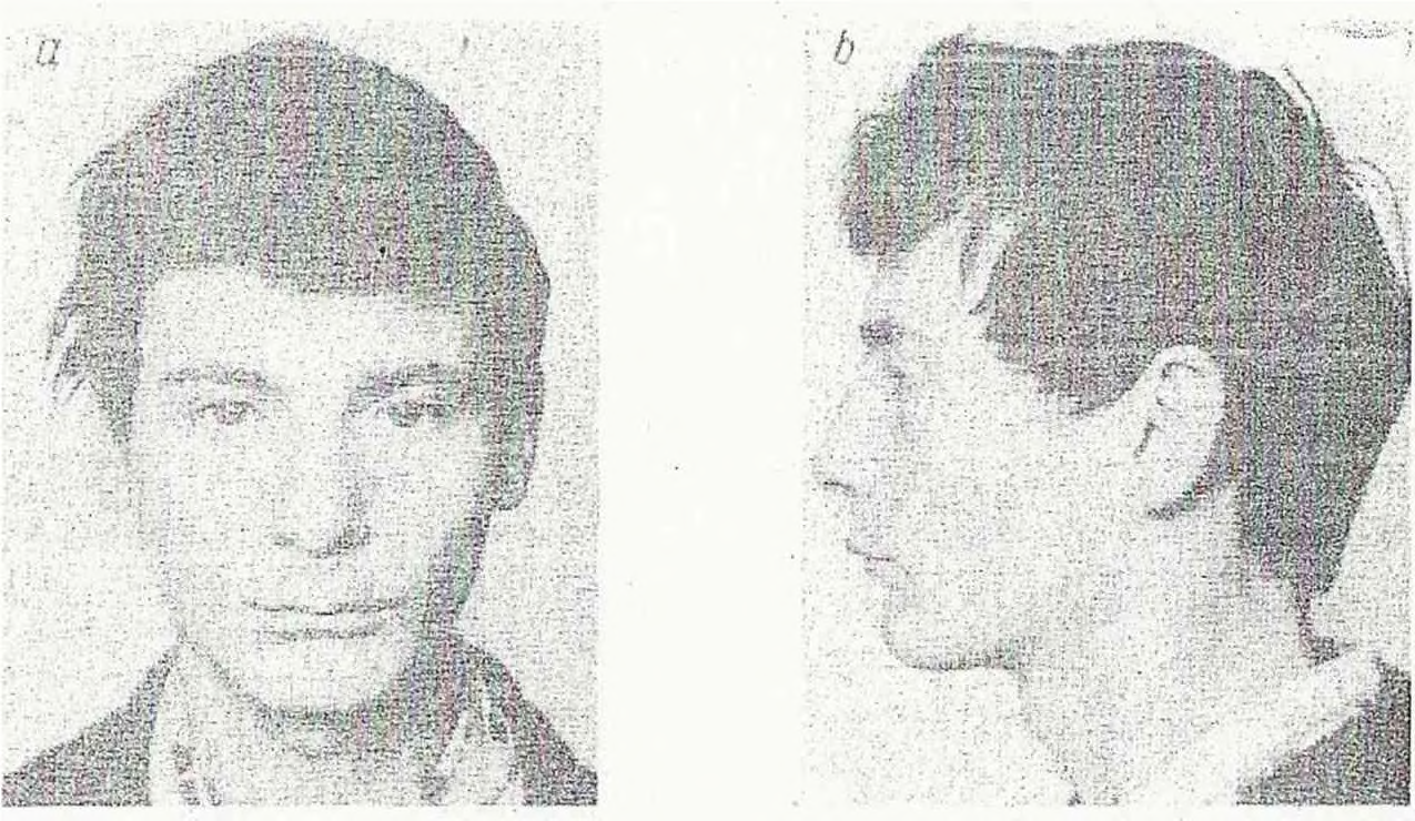 fot 12a i b przedstawiciel typu sublaponoidalnego (EL), (mieszaniec rasy śródziemnomorskiej z laponoidalną) Wzrost przeważnie niski, górna granica dla mężczyzn 169 cm.