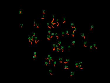 Zastosowanie sieci neuronowych... a) b) Rys. 1.