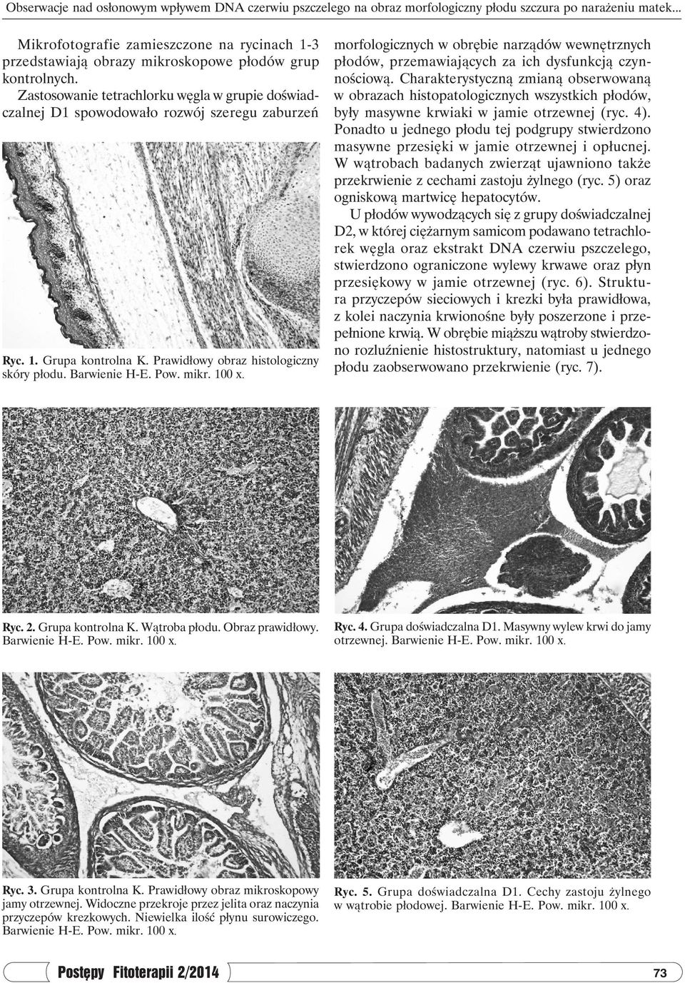 Zastosowanie tetrachlorku węgla w grupie doświadczalnej D1 spowodowało rozwój szeregu zaburzeń Ryc. 1. Grupa kontrolna K. Prawidłowy obraz histologiczny skóry płodu.