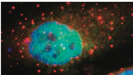 Ciałka P (P-bodies) przechowywanie nieaktywnych translacyjnie mrna po mirna