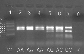 40 elektroforetycznemu. Na podstawie wzoru prążków identyfikowano trzy różne genotypy: AA, AC i CC (Rycina 7). Rycina 7. Przykładowy żel agarozowy, wybarwiony bromkiem etydyny.