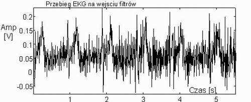 Zastosowany sposób pomiaru z różnicowym sygnałem pomiarowym, powoduje że zakłócenia współbieżne jakie "przenikają" do odprowadzeń elektrod (głównie od sieci), są eliminowane.