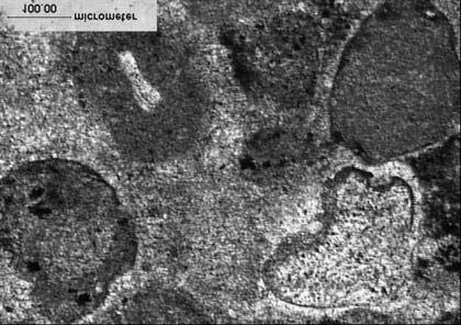 77 Rys. 9. Próbka 7 z utworów wapienia muszlowego Fig. 9. Sample 7 taken from Muschelkalk sediment Rys. 11. Obraz mikroskopowy próbki 9, 1N pow. 100 Fig. 11. Microscopic view of sample 9, 1N, Enlargement 100 Rys.