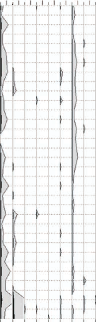 Joanna Pajewska, Anna Pêdziszewska Wyniki Historia roślinności leśnej Diagram pyłkowy (ryc. 2) wskazuje, że zbadany fragment profilu obejmuje znaczną część okresu borealnego oraz okres atlantycki.