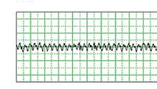 Dane techniczne Porównanie gładkości powierzchni Po obróbce pierwszego detalu Po obróbce 125 detali (µm) (µm) 3025 Cermetal konwencjonalny 10.0 5.0 0.0-5.0 Rz=2.68 równomierna gładkość -10.0 0mm 1.