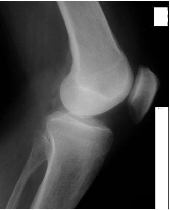 Moduł 3. Wymagania egzaminacyjne z przykładami zadań Książka ewidencji badań radiologicznych (fragment) Formaty kasety Lp.