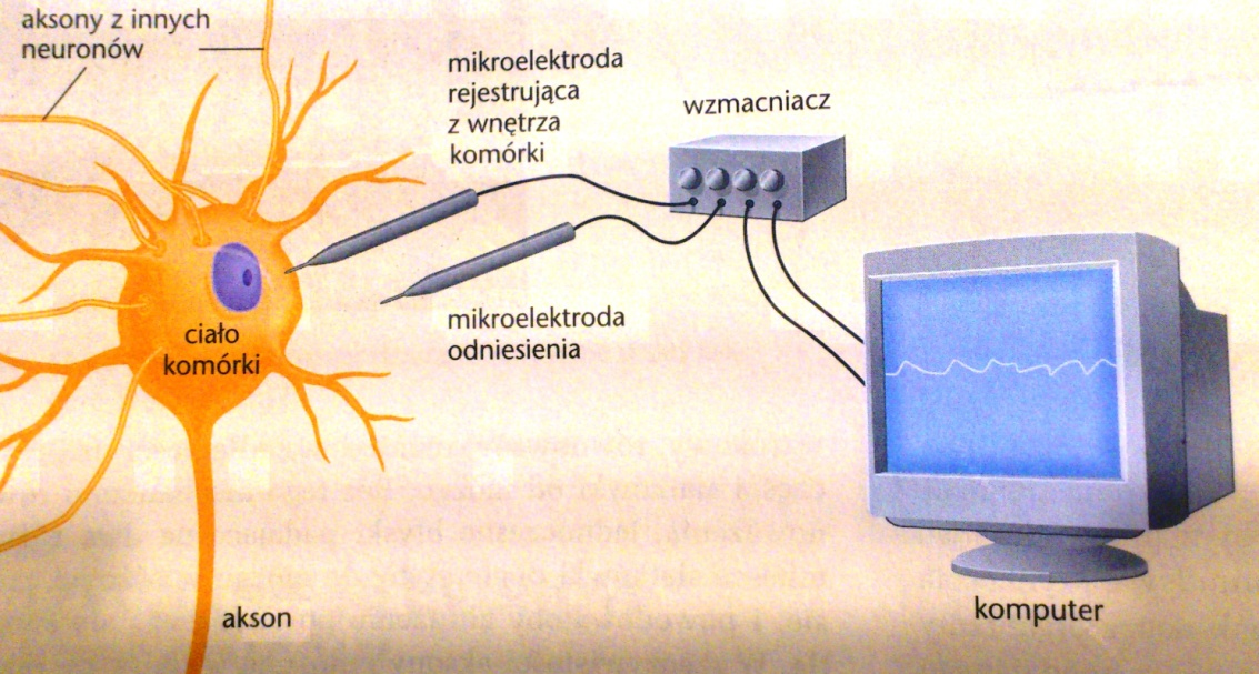 3. Demielinizacja to patologiczny proces polegający na rozpadzie osłonek mielinowych w układzie nerwowym. Jak myślisz, jaki wpływ może mieć ten proces na funkcjonowanie człowieka?