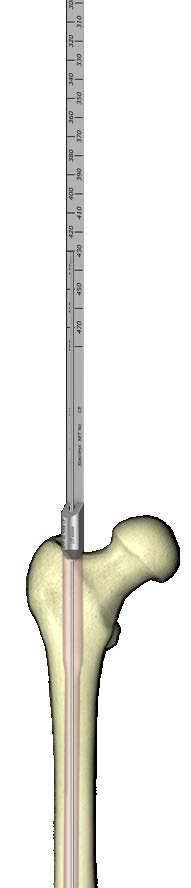 580 5 Drut prowadzący [40.3925.580] o długości 580 mm zamocować w uchwycie [40.