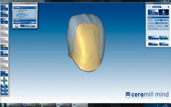 A-D Ceramill Liquid FX Szczegółowe parametry podbarwiania patrz strona 9 POZIOM PODSTAWOWY