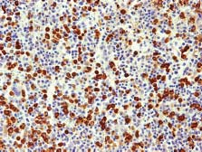 strzałka); (D) Ekspresja CD57 na limfocytach T zlokalizowanych w zatokach i