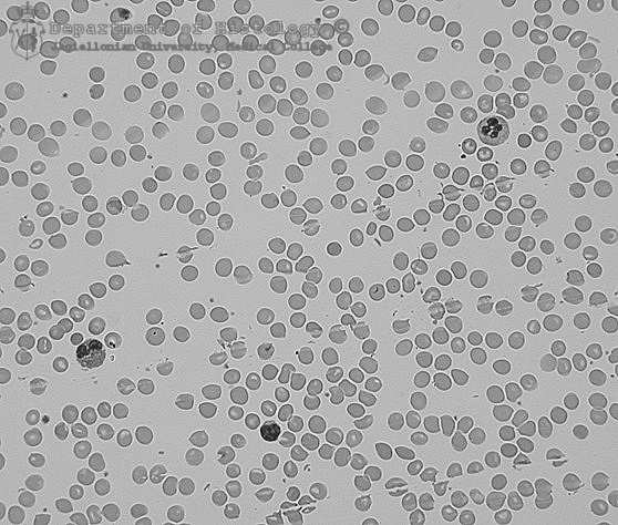 krwi, komórki budujące soczewkę