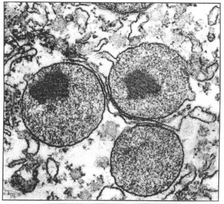 grzybki mitochondrialne - tu następuje synteza ATP Peroksysomy