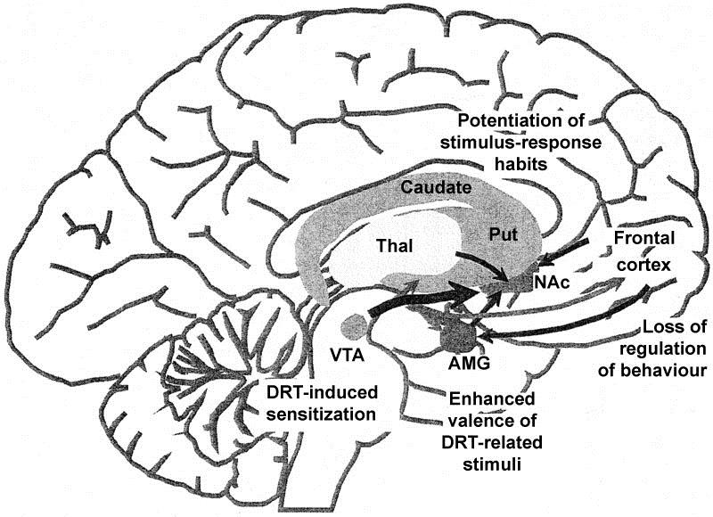 Zespół dysregulacji dopaminowej DDS, dopamine dysregulation syndrome Taylor i wsp.