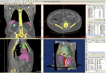 opaska Body Media Sensewear MF; SECA 285 stacja pomiarowa do określania wagi i wzrostu; orteza Hakafo Erhem; pionizator dynamiczny PD MDH; wózek inwalidzki aktywny Sagitta Vermeiren; wózek inwalidzki