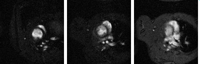 138 1. Introduction This paper presents the usage of image analysis methods for solving the problem of the right ventricle detection in the rat's hearts.