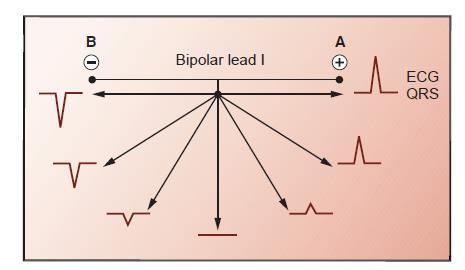 Gdy potencjał czynnościowy jest skierowany w kierunku elektrody dodatniej - w zapisie EKG obecne jest odchylenie w górę Wielkość odchylenia w EKG jest proporcjonalna do ilości tkanki wytwarzającej