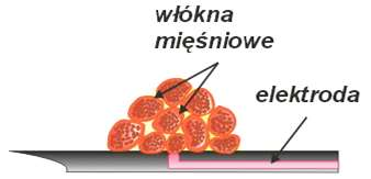 Single Fiber EMG (SF EMG) Liniowe rozmiary powierzchni czynnej elektrody nie powinny być większe niż połowa średnicy włókna, która zawiera się w przedziale 60-100 m.