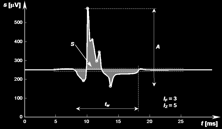 Parametry czasowe stosowane w EMG A. I.