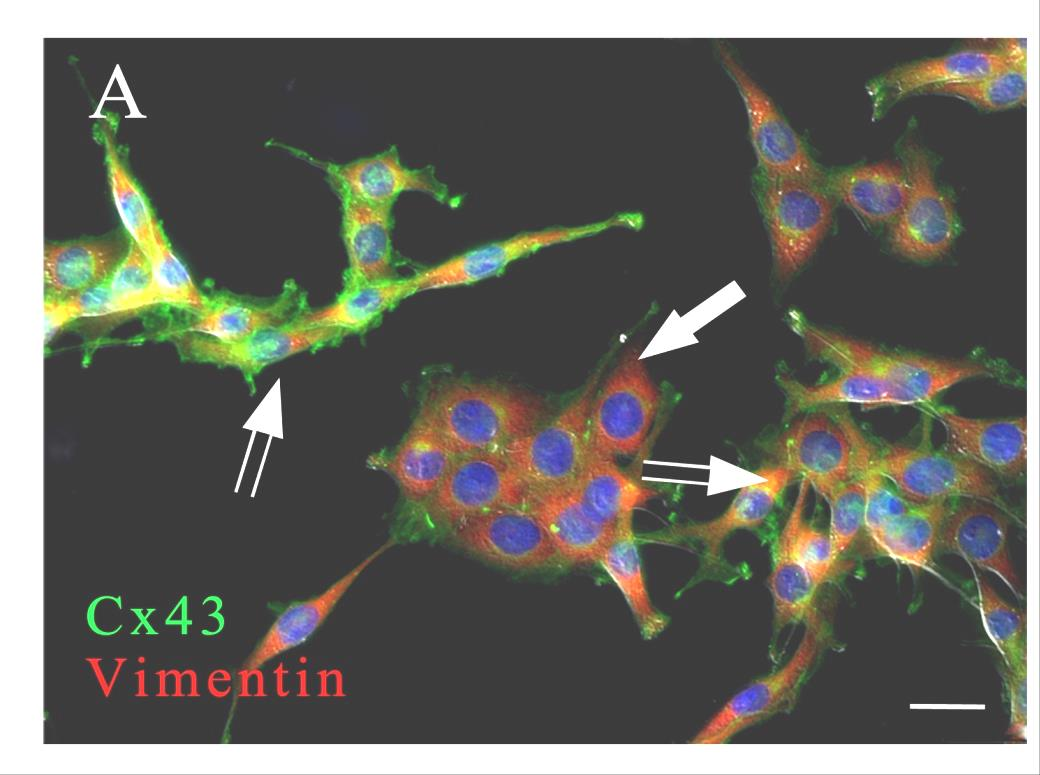 Funkcjonalna heterogenność komórek AT-2 Ryszawy et al.