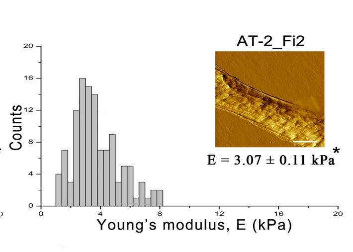 Pętle wspomagania między Cx43 a inwazyjnym fenotypem komórek AT-2_Fi2 Cx43 silencing induces MET in AT-2_Fi2 cells Snail-1 silencing induces MET and Cx43