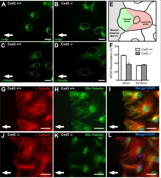Zaaangażowanie Cx43 w stabilizację mikrotubul Wpływ na polaryzację ruchu komórek PLoS One.