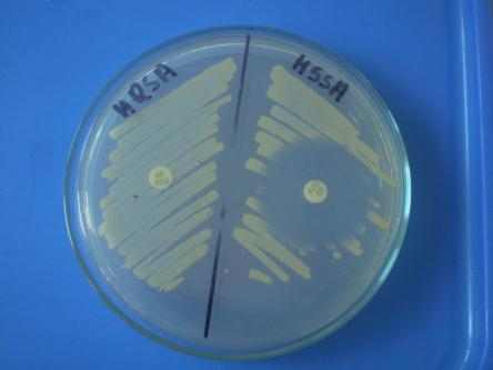 Ćwiczenie 3. Mikrobiologia ogólna - Identyfikowanie bakterii na podstawie ich cech biochemicznych i antygenowych.