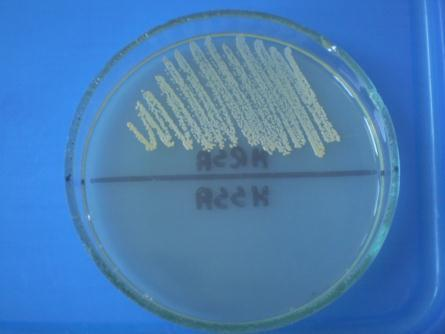 Metody wykrywania szczepów gronkowca złocistego opornych na metycylinę (MRSA ang.